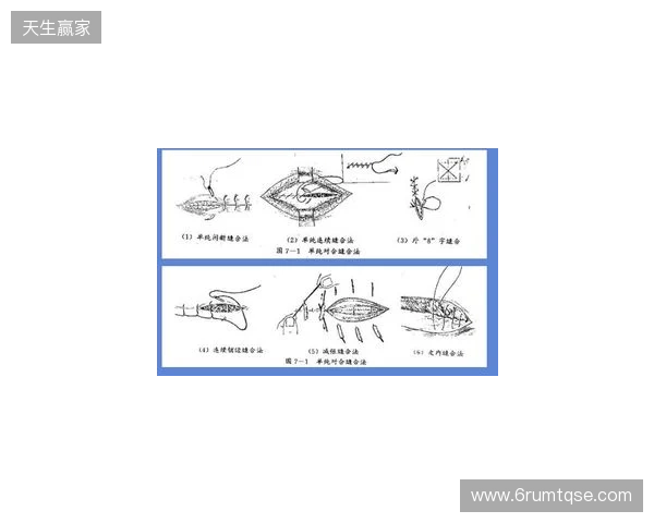 广州豹官方:杨浩眉弓伤口缝合30余针,预计5-7天后拆线 广州豹官方:杨浩眉弓伤口缝合30余针,预计5-7天后拆线